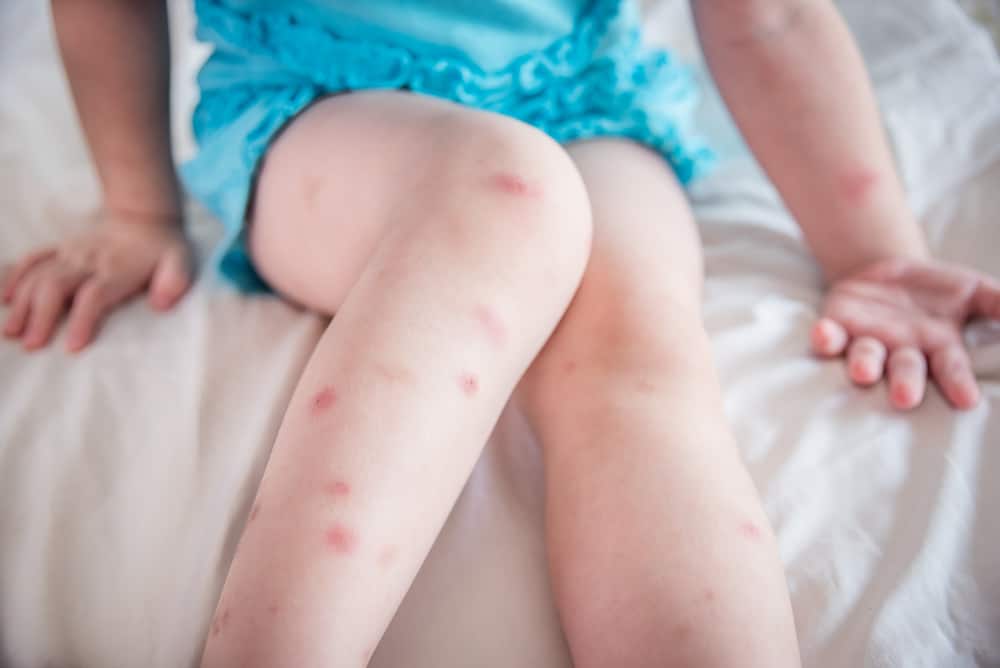 How Can You Prevent Bed Bugs?
