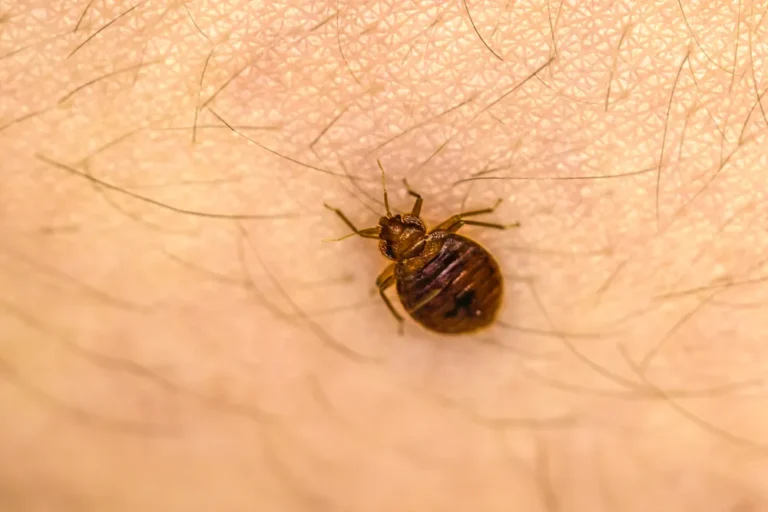 Bed Bug on Skin Hair