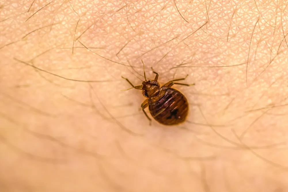 Bed Bug on Skin Hair
